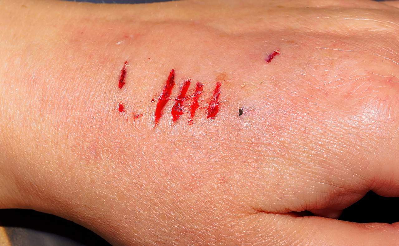 A rabbit bite wound. what to do if your rabbit bites you