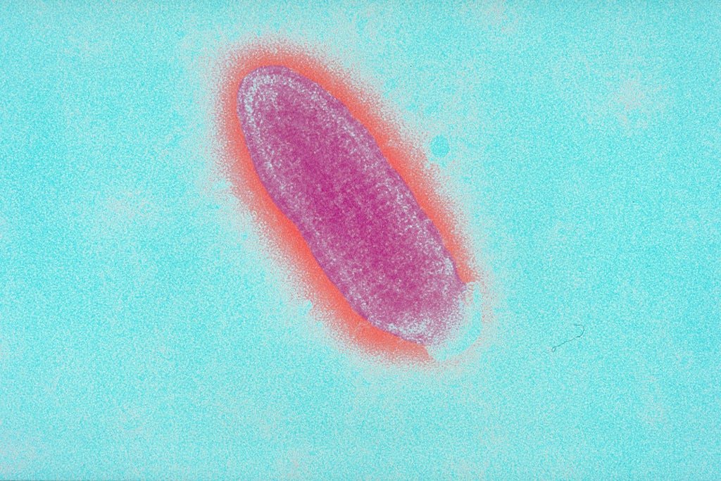 Rabies virus seen in an electron microscope
